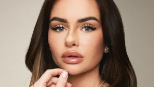 Thumbnail voor Sarah van Soelen over haar fillers: 'Ging - net als met drugs en alcohol - ver over mijn grens'