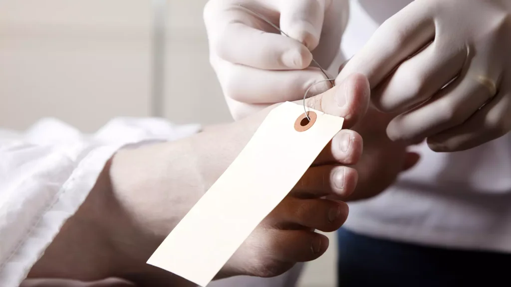 Amerikaan lichamen onderdelen verkopen