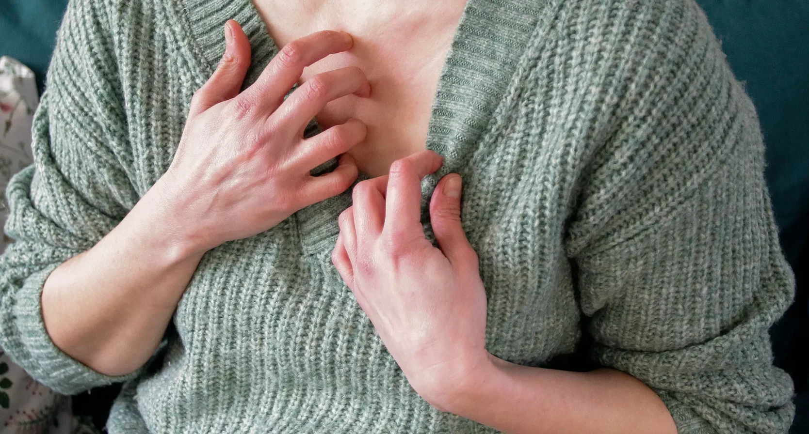 Sanne gaf haar schoonmoeder schurft: Deed alsof neus bloedde