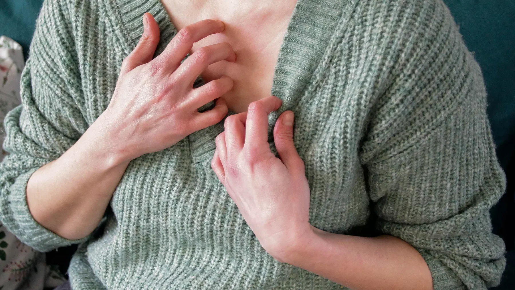 Sanne gaf haar schoonmoeder schurft: Deed alsof neus bloedde