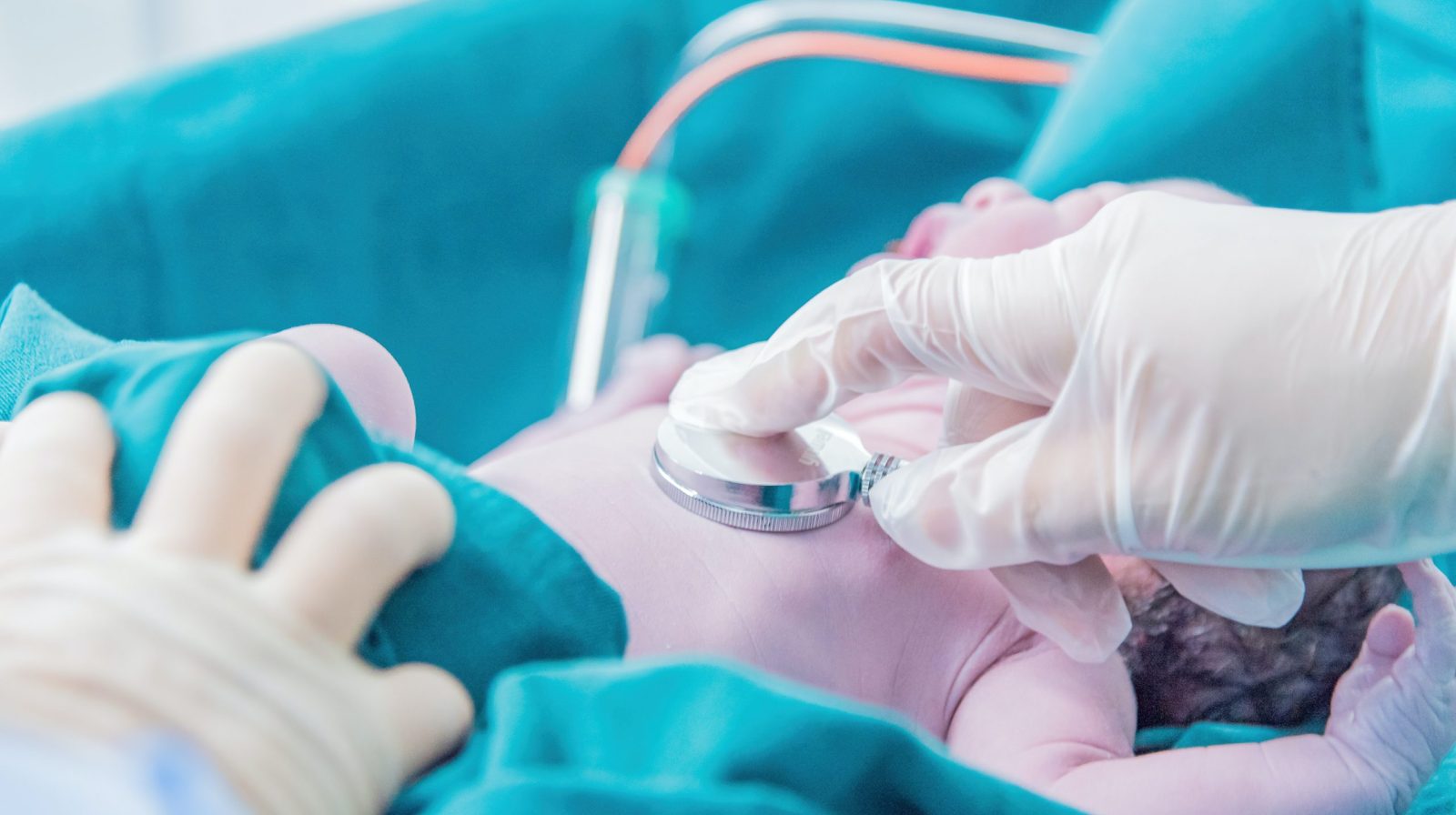 Minister Kuipers kan voorlopig door met centralisatieplan kinderhartchirurgie