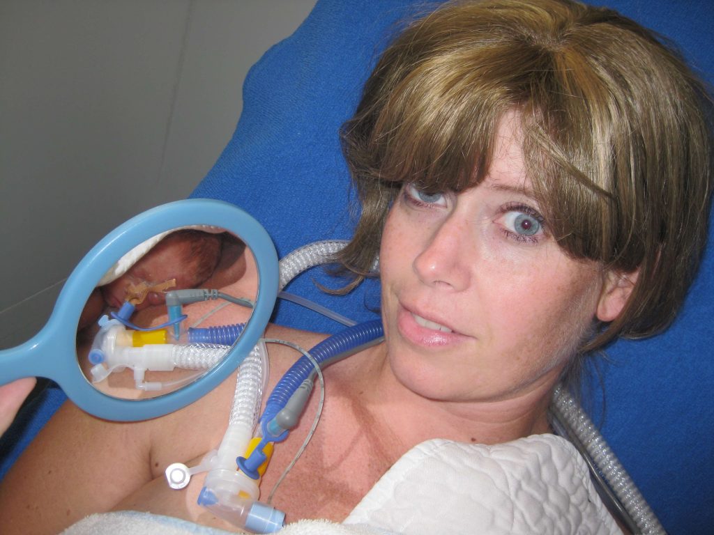 Claudia's zoon werd met 28 weken geboren: 'Hij moest aan de beademing'