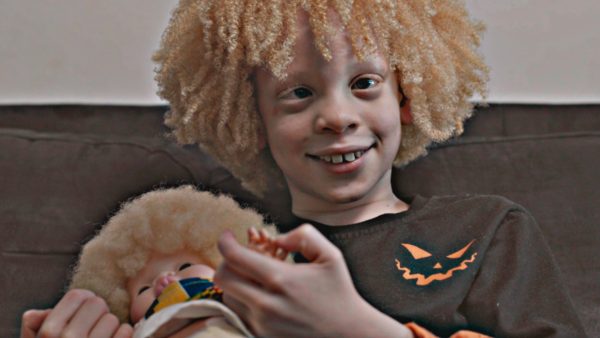 Elisanio (7) heeft albinisme en vindt herkenning in 'Een pop zoals ik'