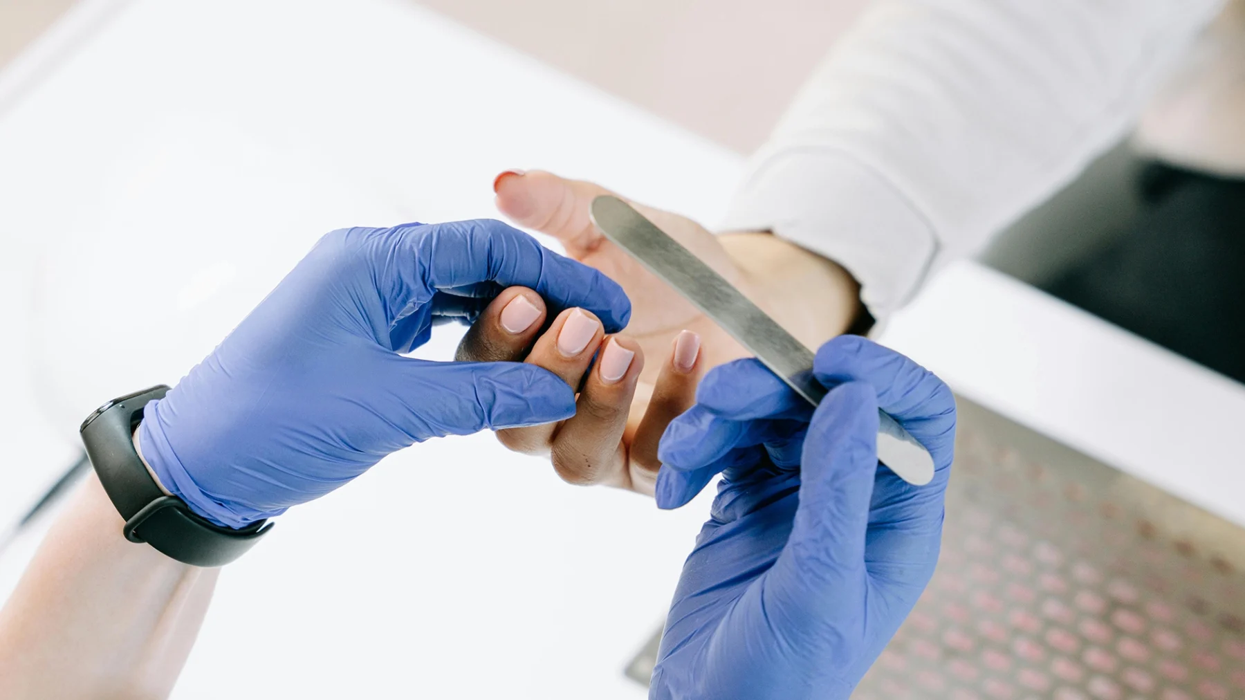 Allergie voor kunstnagels kan grote gevolgen hebben: 'Heb het aan moeten geven bij de tandarts'