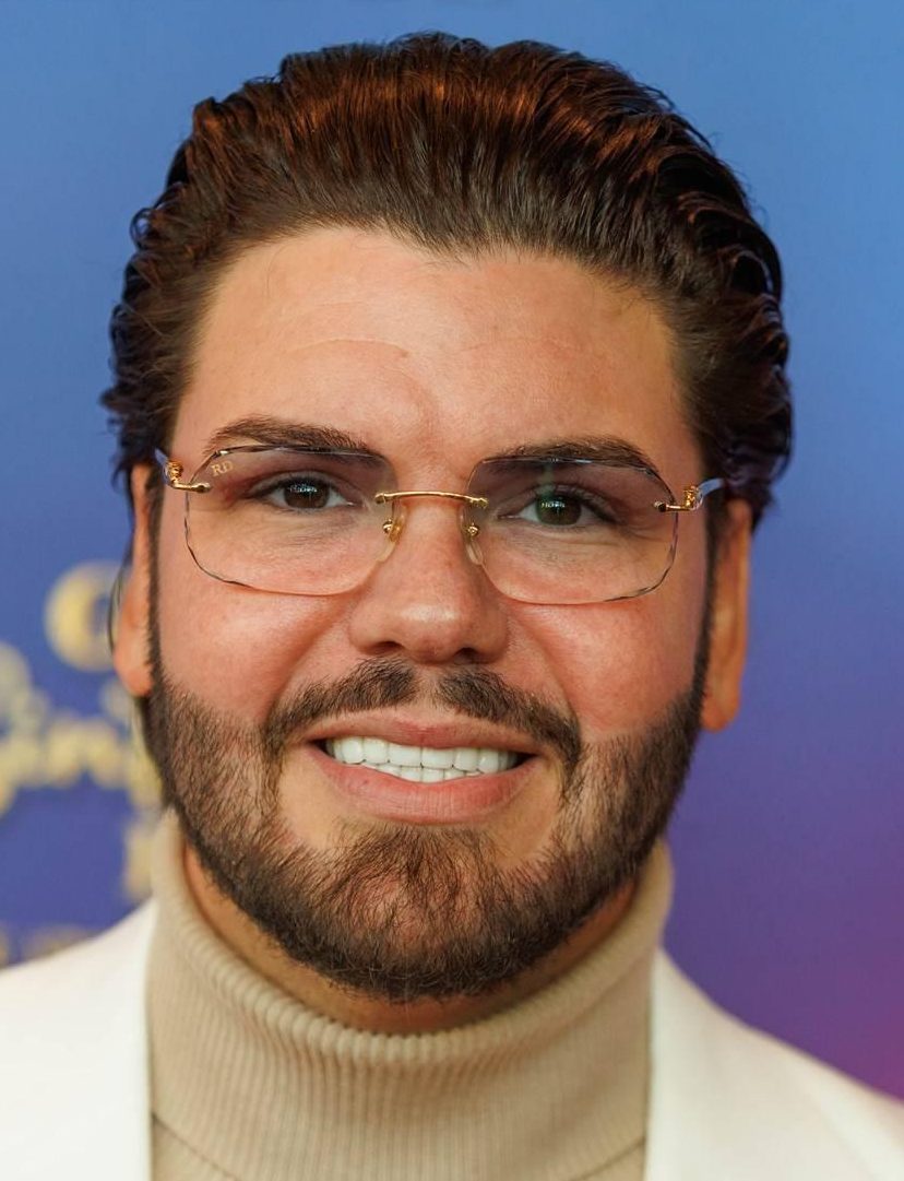 Roy Donders krijgt waarschuwing na zetten van fillers zonder juiste papieren