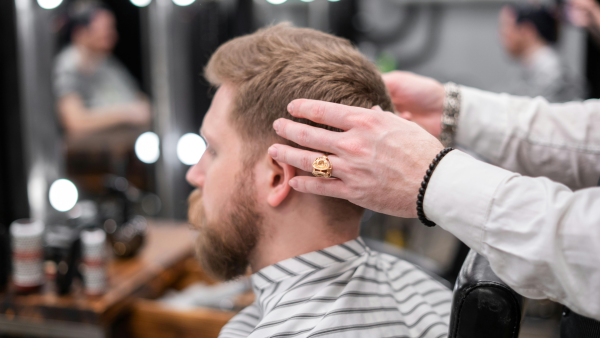 Haartransplantatie