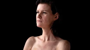 Thumbnail voor Dafne herstelde van tweede keer kanker door borstamputatie: 'Toch deed ik vlak na de operatie een fotoshoot'
