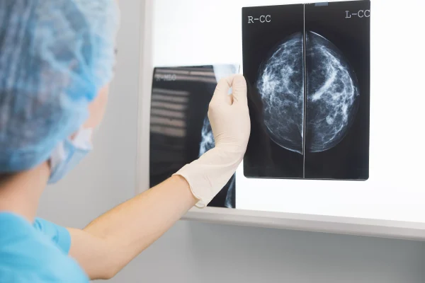 Dit ziekenhuis zet AI in bij beoordelen mammografie: 'Om borstkanker eerder te ontdekken'