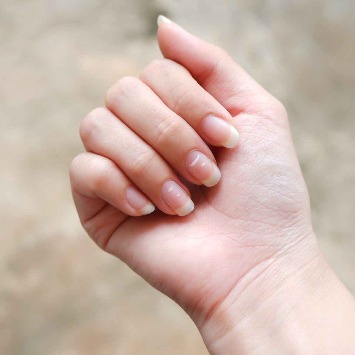 Nagels witte vlekjes vrouw