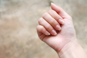Thumbnail voor Nagelexpert legt uit: dít betekenen die witte puntjes op je nagels