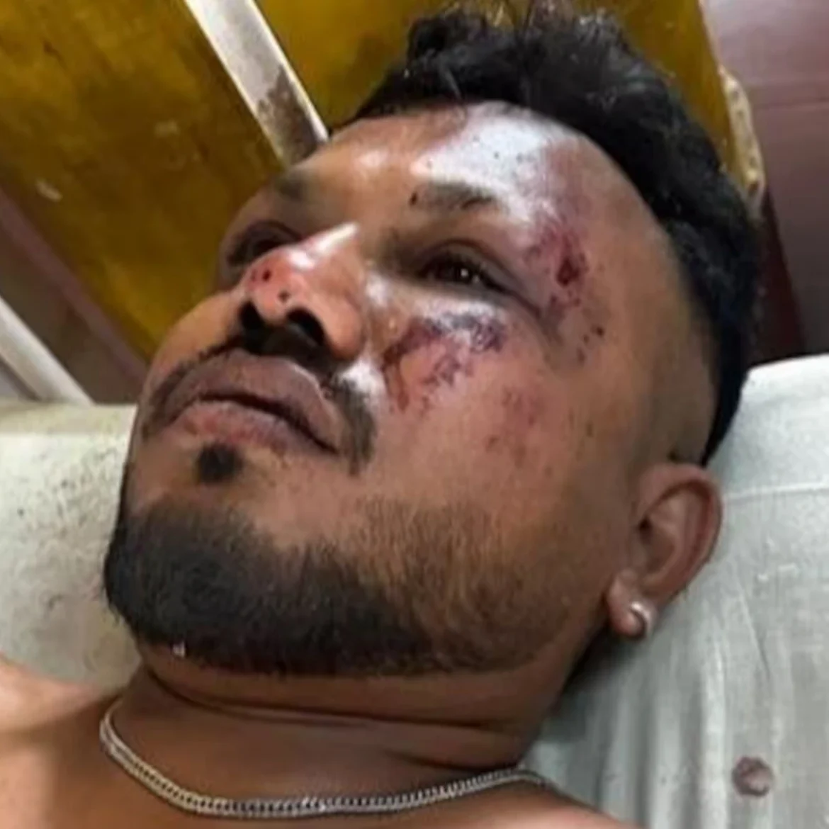 Familie enige overlevende vliegtuigcrash India in shock: 'Hij vroeg meteen naar zijn broer'