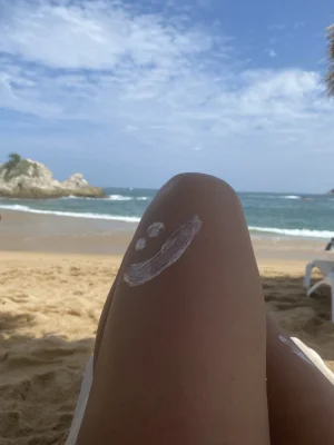 Thumbnail voor Plak- en puistproof: deze zonnebrandtips gaan rond in de LINDA.meiden groepschat