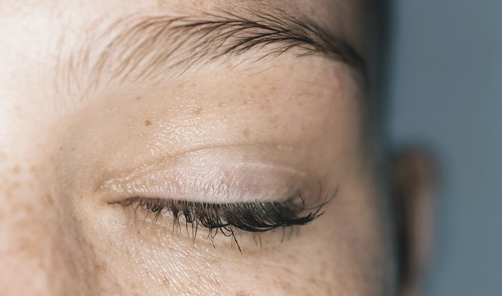 Wimperuitval voorkomen