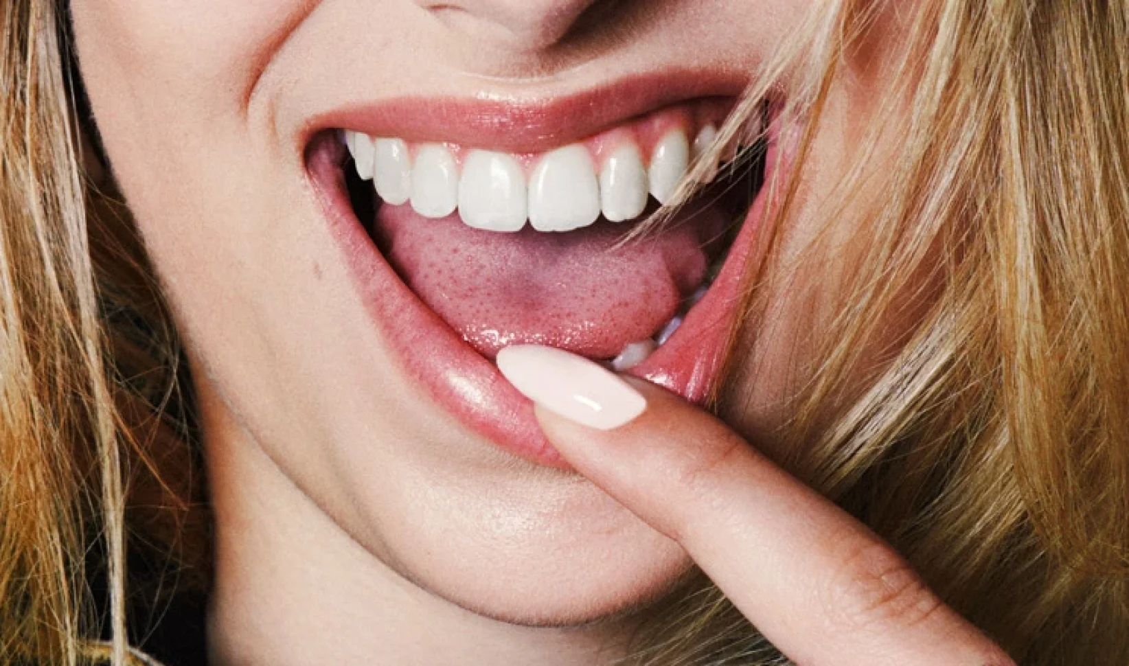 roxy dekker | tong gezondheid