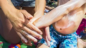 Thumbnail voor Ouders beschermen kinderen niet goed genoeg tegen de zon: te duur of te veel gedoe