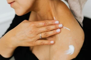 vrouw smeert crème op schouder
