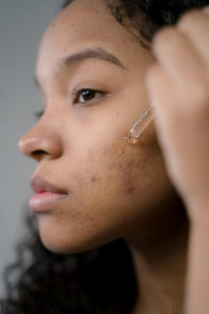 Thumbnail voor Plots last van hormonale acne? Zó herken je het – en dit kun je eraan doen volgens huidexpert Jetske Ultee