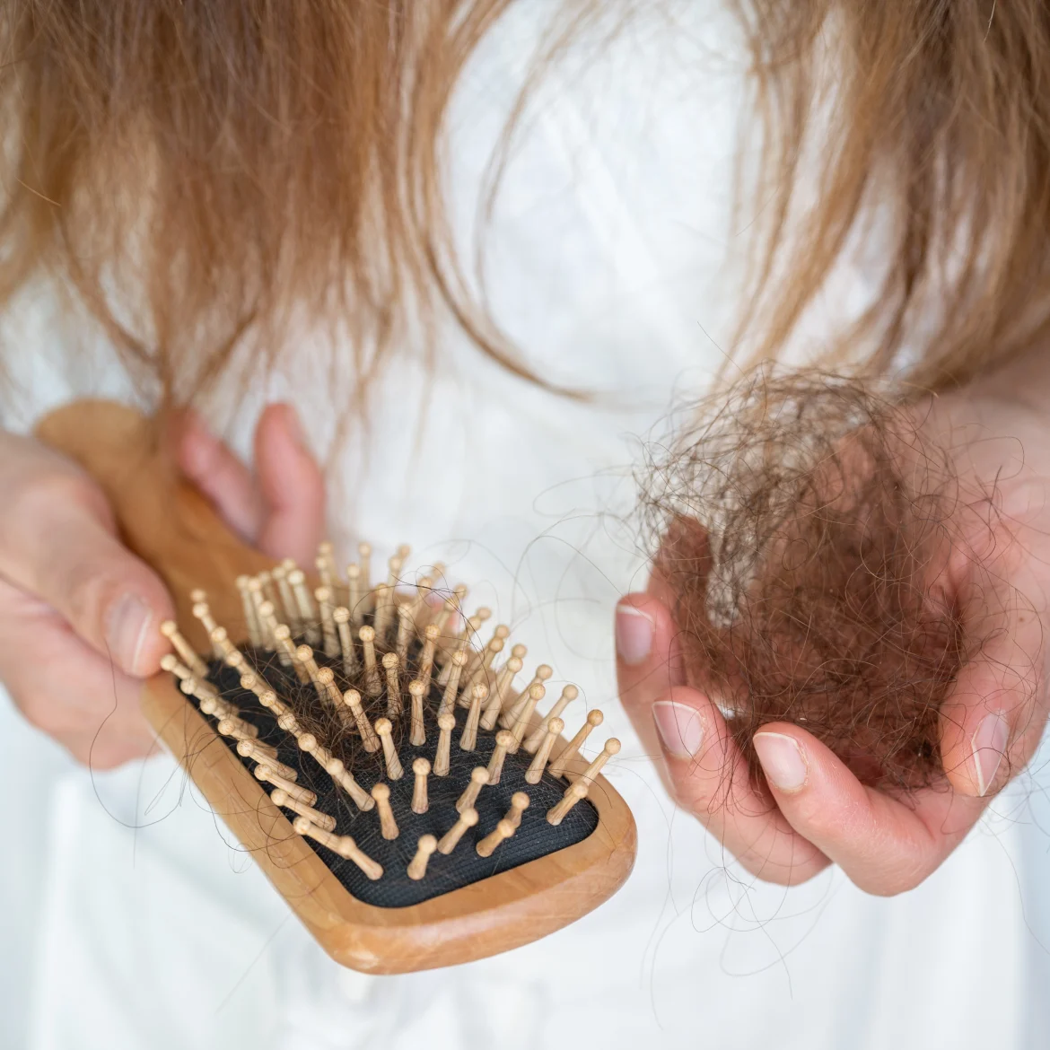 Vrouw met haaruitval (en oorzaak)