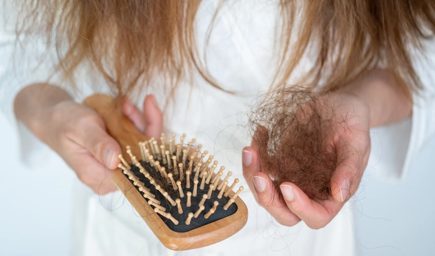 Vrouw met haaruitval (en oorzaak)