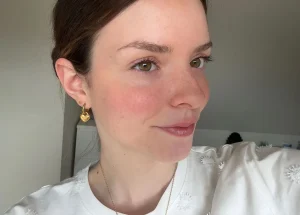 Thumbnail voor Kirsten verliest onderbeen door botkanker: 'Heb tijd nodig mezelf weer mooi te vinden'