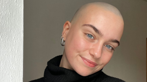Thumbnail voor Anne is al negen jaar kaal door alopecia: 'Vond mezelf zo mooier dan met een paar plukken'