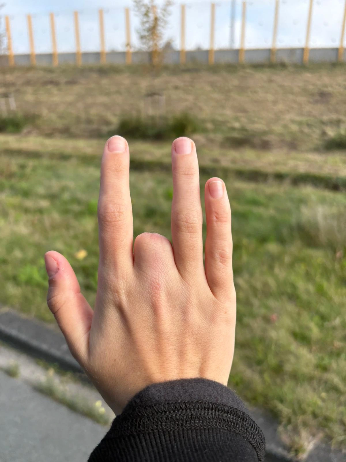 Jasmins hand na ongeluk