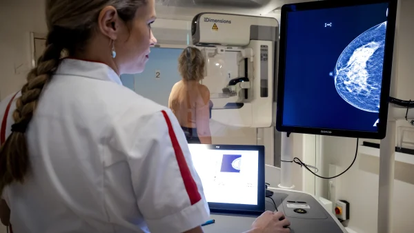 Demissionair kabinet wil MRI-scans voor vrouwen met dicht borstweefsel 'zo snel mogelijk realiseren'