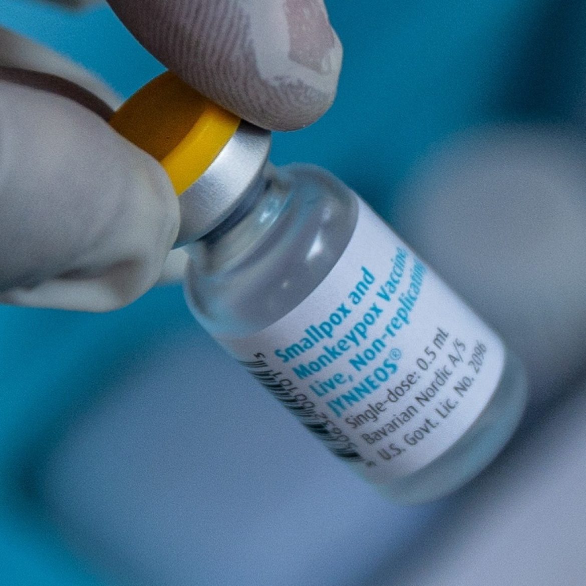 Mpox-variant vastgesteld in Nederland: wat is het en hoe bezorgd moeten we zijn?