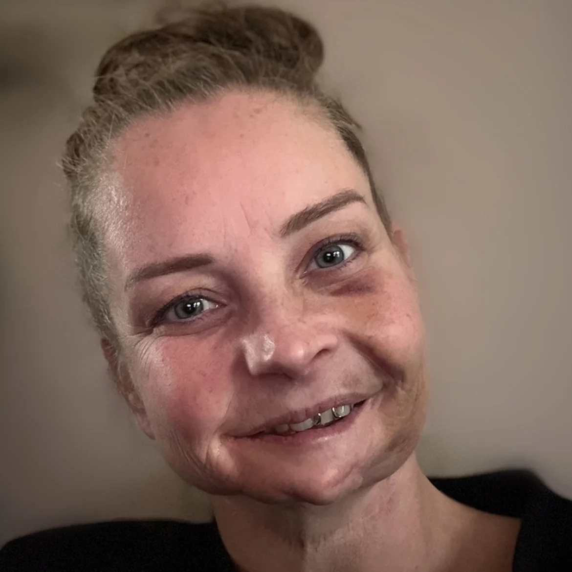 Chantal heeft het Li-Fraumeni syndroom