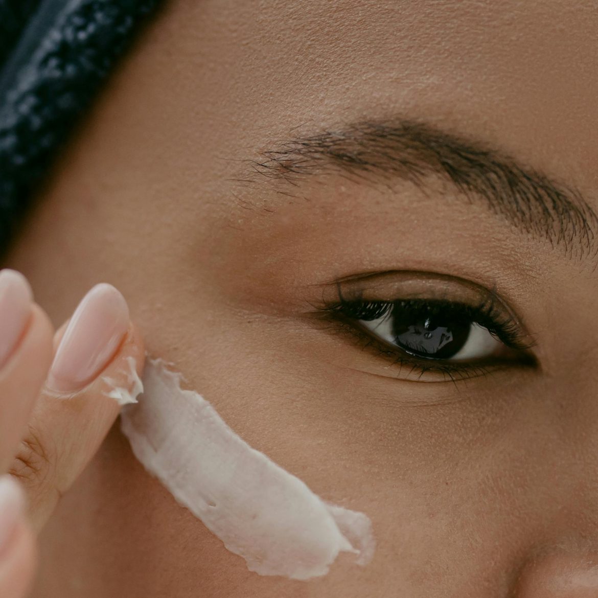 Iedereen heeft 't over dit product tegen een rode huid (en ook deze BN'ers zijn fan)