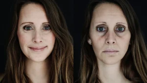 Thumbnail voor Menstruatieziekte PMDD is heftiger dan je denkt: 'Sommige vrouwen kunnen niet meer werken'