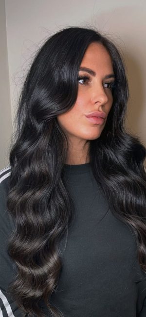 Thumbnail voor Shirleys vulvalip raakte ernstig misvormd na mislukte ingreep: 'Zat vastgenaaid aan mijn bovenbeen'