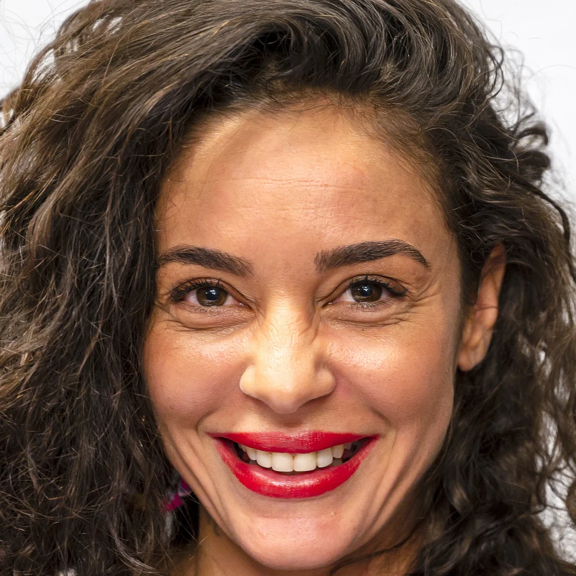 Fajah Lourens wil misverstand over ingrepen ontkrachten: 'Het komt door zwelling'