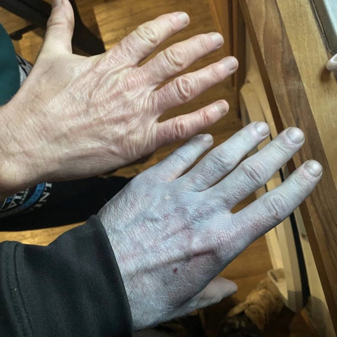 Britse man wordt blauw wakker en schrikt zich rot: 'Schaamde me'