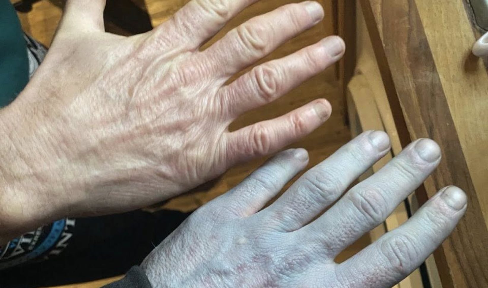 Britse man wordt blauw wakker en schrikt zich rot: 'Schaamde me'