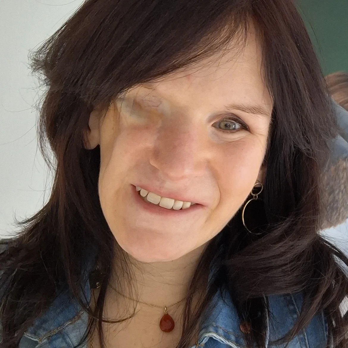 Jacky Ghijsen verloor haar oog, kaak en gehemelte door kanker