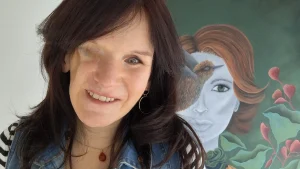 Jacky Ghijsen verloor haar oog, kaak en gehemelte door kanker