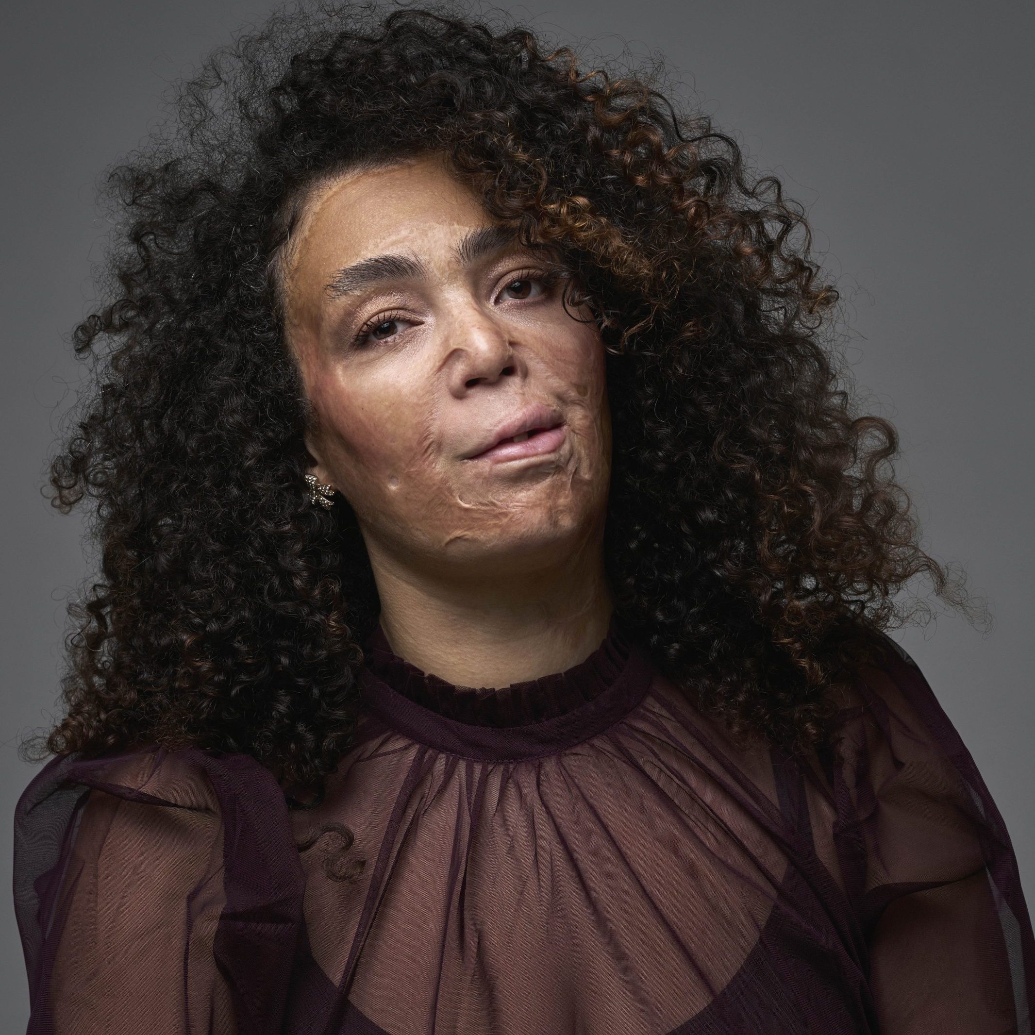 Veronica (39) werd gered uit een brandend huis: ‘Voor mijn moeder en twee zusjes was het te laat’