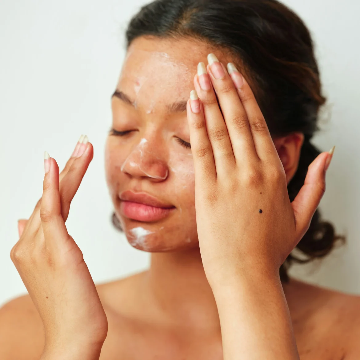 producten, huidproblemen