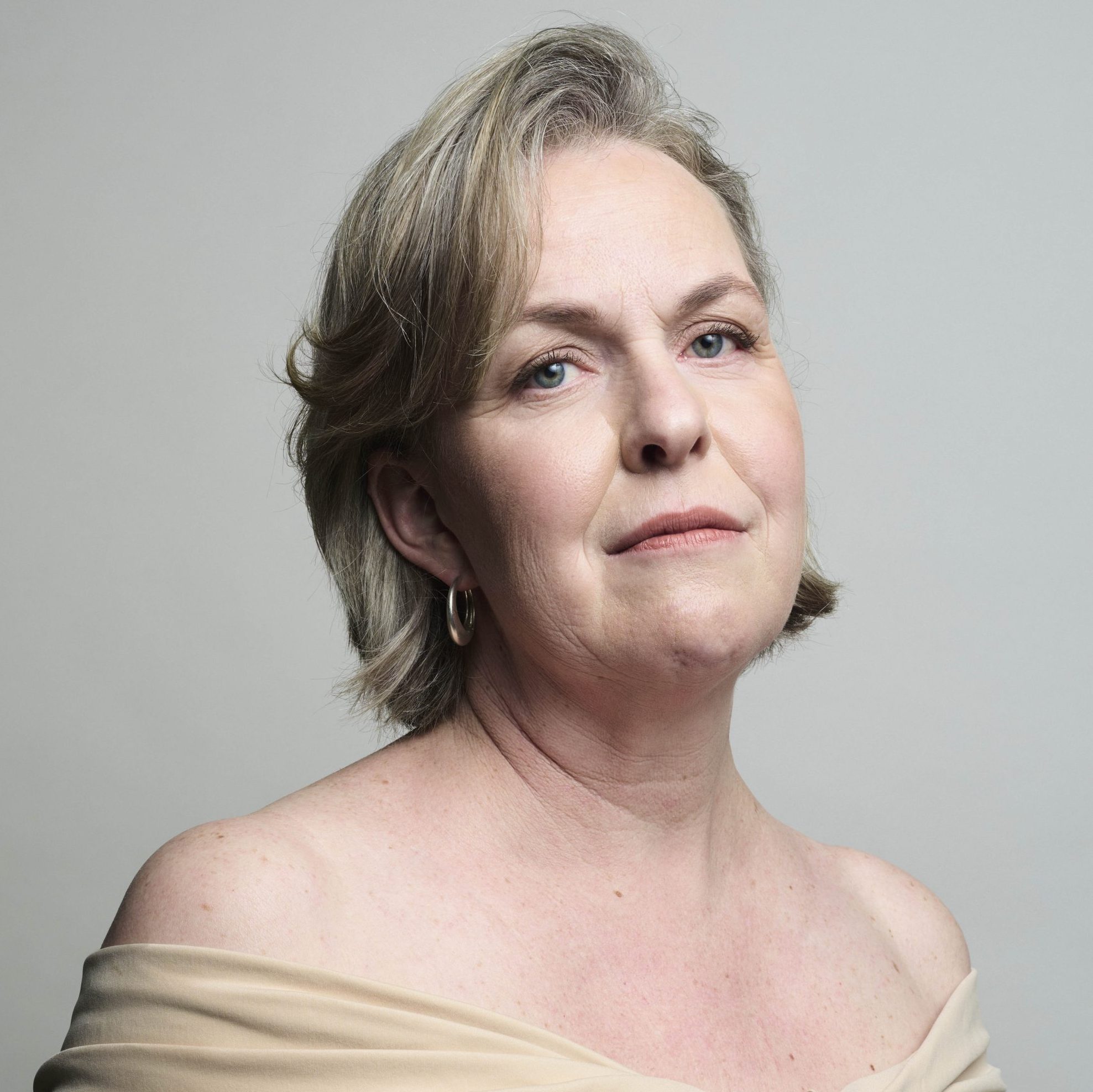 Liesbeth (52) heeft huidkanker: ‘Als kind liep ik ’s zomers met een handdoek over mijn schouders’