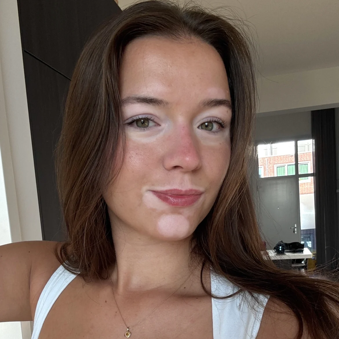 Cato heeft de huidaandoening vitiligo: 'Mijn vriend vindt die vlekken het mooist aan mij'