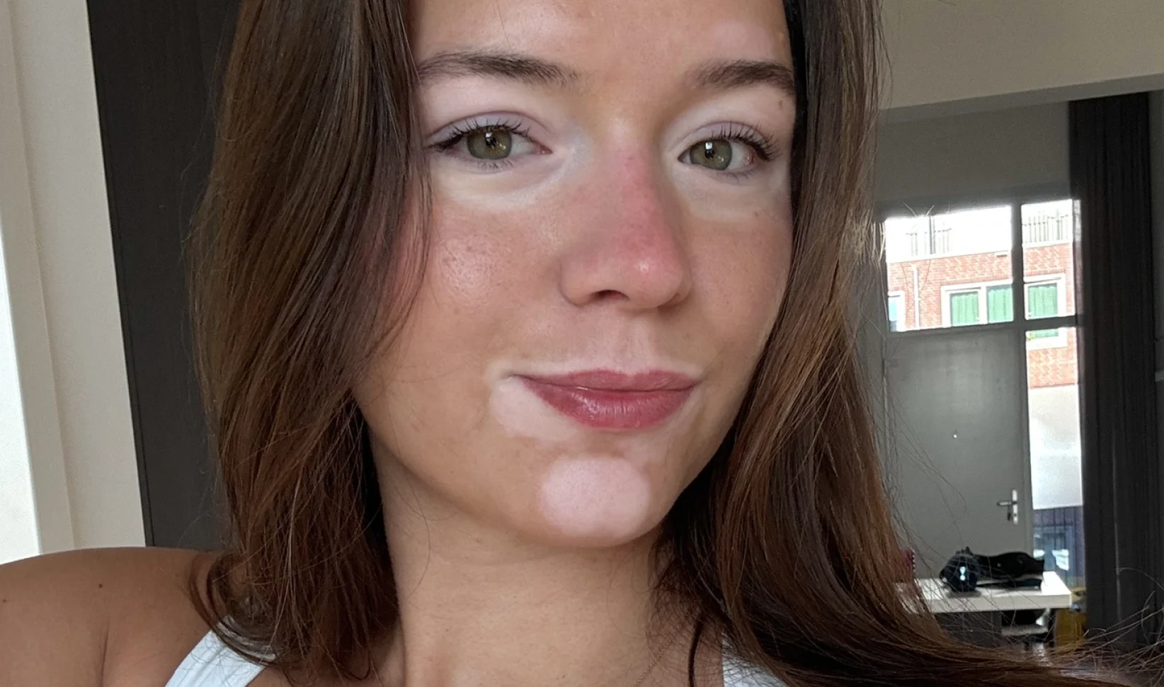 Cato heeft de huidaandoening vitiligo: 'Mijn vriend vindt die vlekken het mooist aan mij'