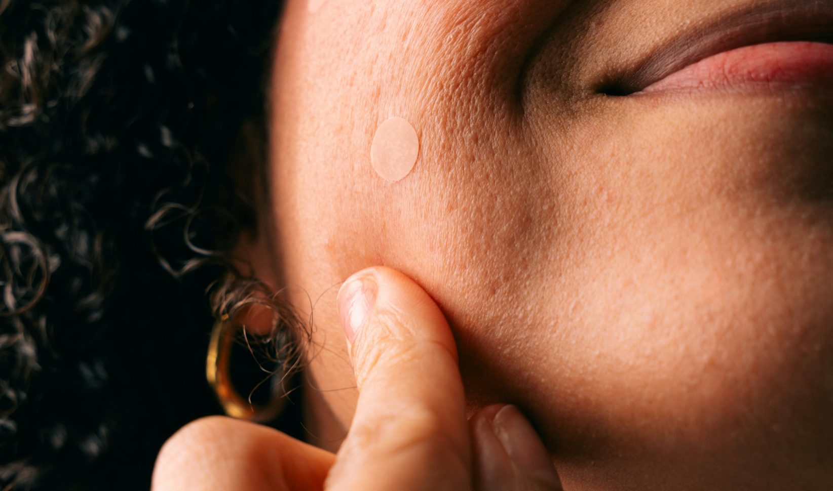 spot treatment puistje