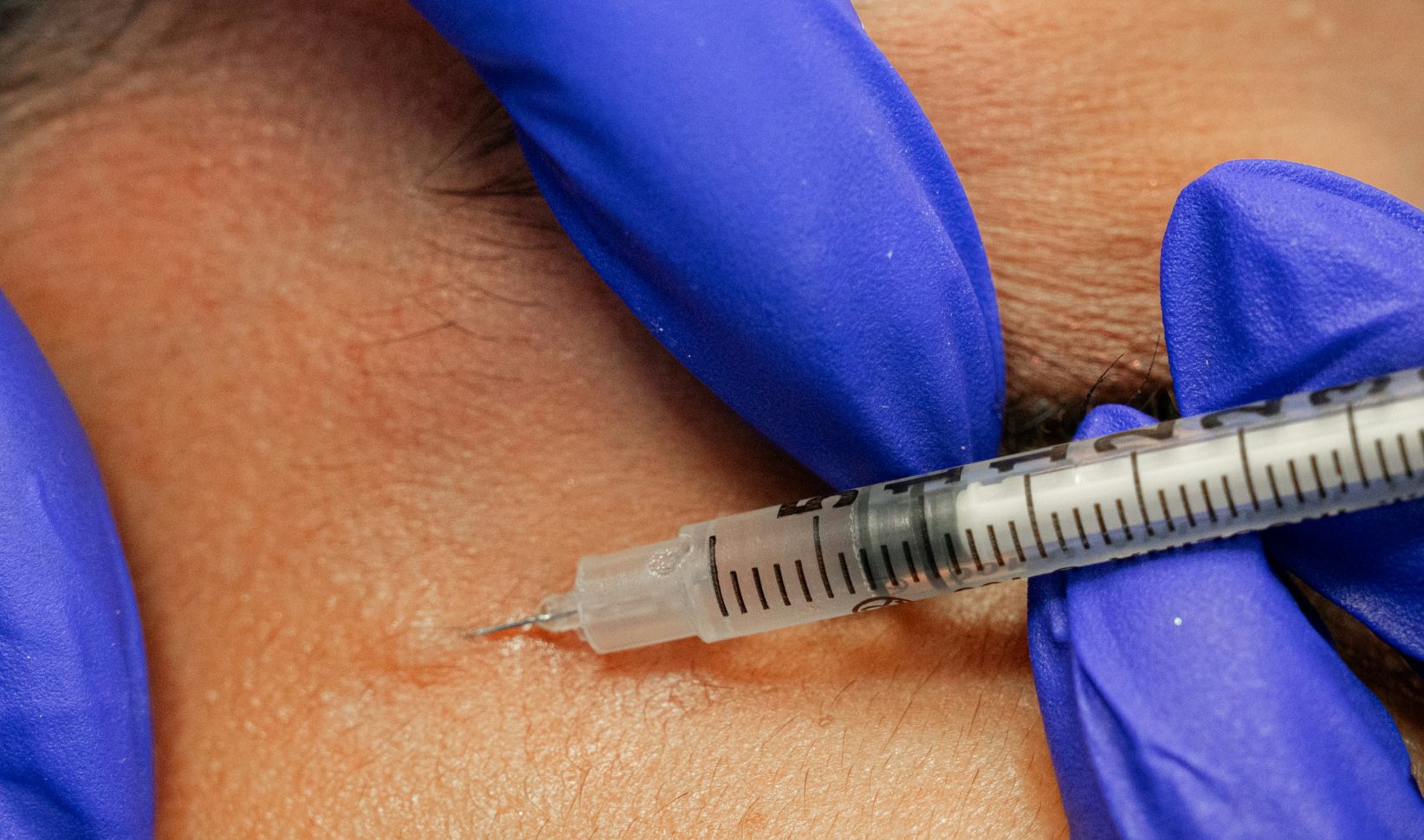 Slecht uitgevoerde cosmetische behandeling meldingen vervijfvoudigd
